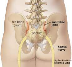 Si Joint Pain In Pregnancy The Mama Coach