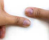 تعرفوا على مشاكل القدم الشائعة لدى مرضى السكري ويب طب