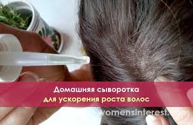 как избавиться от грибка в ухе в домашних условиях Domashnyaya Syvorotka Dlya Uskoreniya Rosta Volos Homemade Hair Products Hair Growth Serum Homemade Hair Growth Serum