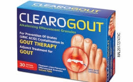 Asid urik ini adalah salah satu dari komponen karbon, nitrogen, hidrogen dan oksigen. Sendi Terkumpul Asid Urik