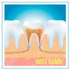 Dentist without insurance near me. Endodontist Near Me No Insurance Ok Root Canal Specialist