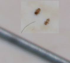 Oct 06, 2020 · 3 tiny bugs you may have flying around inside your house right now. I Have A Black Tiny Bug Crawling All Over The House Biology Stack Exchange