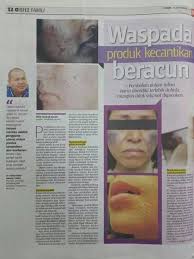 5 jenis produk kecantikan yang selamat & tidak selamat digunakan oleh ibu menyusu badan 1. Pilihan Ditangan Xanzwhite Skincare Jeragat Dan Jerawat Facebook