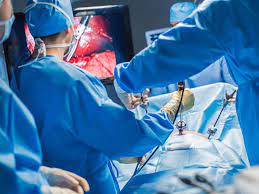 रांची सदर अस्पताल में पहली बार दूरबीन से किया गया हर्निया का ऑपरेशन- Hernia operation was done through telescope for the first time in Ranchi Sadar Hospital