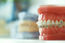 We did not find results for: Orthodontics And Braces Direktori Cari Berita Ciri Dan Gambar Berkaitan Dengan Orthodontik Dan Penyokong Penjagaan Mulut 2021