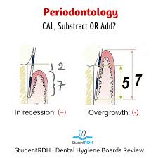 Q Probe Depth Is 7 Mm Recession Is 2 Mm What Is The Cal