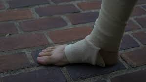 In a closing step, the free foot is brought to the supporting foot and weight is completely transfered. Injured Foot And Bandage Stock Footage Video 100 Royalty Free 21649576 Shutterstock