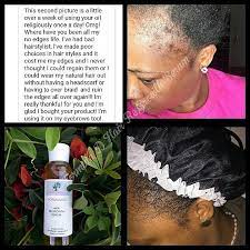 Comparison shop for hair regrowth formula home in home. Hair Oil Formula D Hair Regrowth Serum For Fast Hair Growth Dht Blocker For Men And Women With Jamaican Black Castor Oil