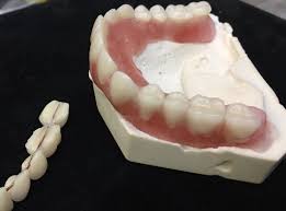 Now you can professionally reline your own denture for only $19 until you can see a dentist. Diy Kit Denture Resin Teeth Upper Lower Best Denture Kit Etsy Diy Dentures Denture Cheap Dentures