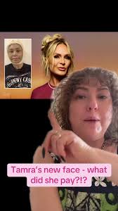 What Happened to Tameras Face