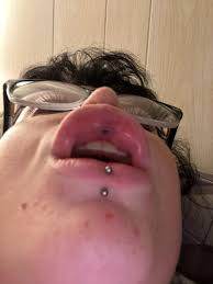 Medusa Piercing: The Pros And Cons Before Making Your Decision