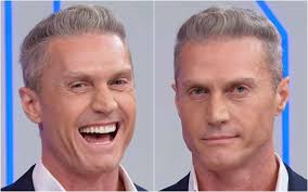 Ex-galã da Record passa por harmonização facial no SBT; veja resultado ·  Notícias da TV