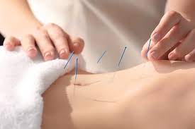 Maybe you would like to learn more about one of these? How Long Does It Take For Acupuncture To Work Holistic Treatment Pa