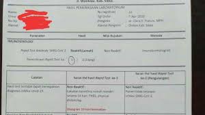 Hasil Rapid Test Negatif Abk Km Lambelu Beredar Di Medsos Pos Kupang