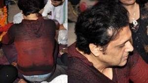 Govinda Shows His Underwear Hair Transplant Patches Video Id 3c1a929e78 Veblr Mobile Khiladi kumar acted smart and opted for a hair transplant before his condition could spiral out of control.
