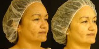 Expertise is second to none