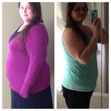 Pin On Gastric Sleeve Surgery Etc