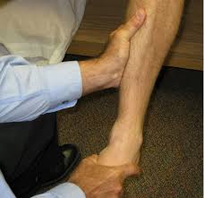 Image result for Ankle External Rotation Test