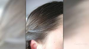 If you have gray hair, you need to treat it the same as anyone born with dry, frizzy hair. How To Treat Grey Hair General Center Steadyhealth Com