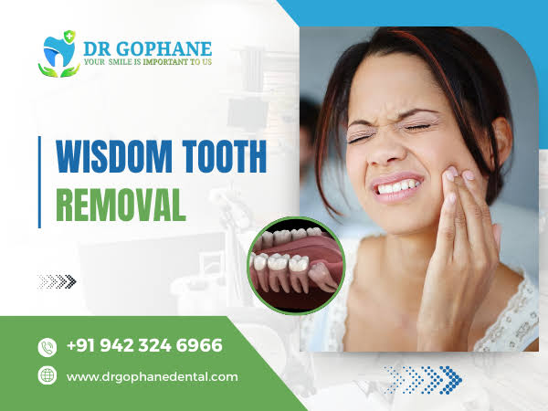 Wisdom Tooth Removal In Yavatmal product image