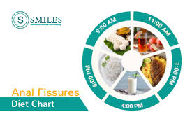 Anal Fissures Diet Chart Fissure Treatment Smiles Bangalore