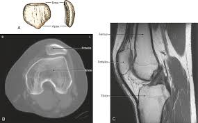 A coronal scan goes through the knee, front. Lower Limb Radiology Key