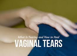 If you've had thrush vaginal thrush isn't classed as a sexually transmitted infection (sti), so sexual partners don't need to be informed, tested or treated if they don't have any. What Is Tearing And How To Heal Vaginal Tears Babycare Mag
