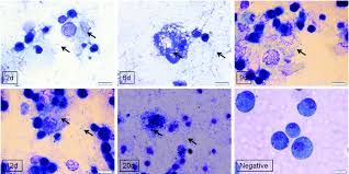 Image result for Rickettsiae