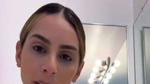 Amazon.com : Anyeluz Anti-Aging Skin Oil, Dry Skin Moisturizer, Prevents  Premature Aging, Expression Lines, and Stretch Marks, Paraben Free : Beauty  & Personal Care