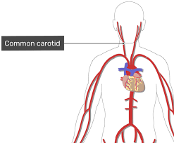 I see (i.c.) = internal carotid artery; Major Systemic Arteries