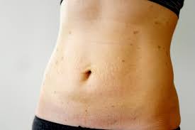 Maybe you would like to learn more about one of these? Is It A Hepatitis C Rash