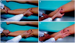 Image result for Patellar Apprehension Test