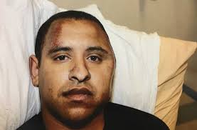 Schenectady cop recalls brutal attack in student address