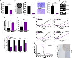 Nalazimo se na prometnom mestu u srcu žarkova, u ulici trgovačka 79, u blizini velikog tržnog centra u čijem se sastavu nalazi vero , poznati maloprodajni lanac. The Rna Binding Protein Serbp1 Functions As A Novel Oncogenic Factor In Glioblastoma By Bridging Cancer Metabolism And Epigenetic Regulation Genome Biology Full Text