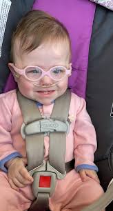 Will Nystagmus cause vision challenges in children?