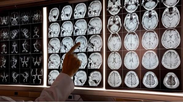 What Is Neurology? Doctors, Tests, Procedures and Expert Q&A | Castle  Connolly