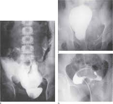Image result for Genitourinary Trauma