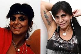 'sonhei ser a barbie, mas fui apelidada de wolverine'. Famosas Que Investiram Em Cirurgias Plasticas Para Mudar O Visual