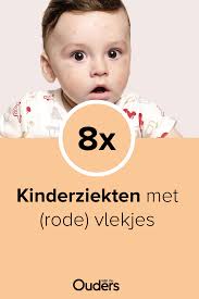 Kinderziekten Met Rode Vlekjes Kind Koorts Baby Tips Baby Verzorging