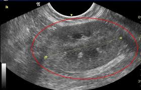 Kidney Disease In Dogs Cats Long Beach Animal Hospital