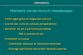 Si distingue in primitiva o secondaria. Prise En Charge Des Peritonites Ppt Video Online Telecharger
