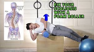Alternative to traditional foam roller: Pin On Scolio Pilates