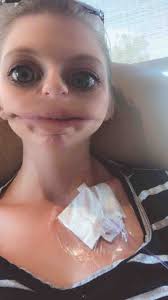 Fundraiser for Rebecca Gale by Laura Redmond : Rebecca's Chemotherapy and  Recovery from GTN