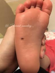 足 の 裏 ほくろ 子供