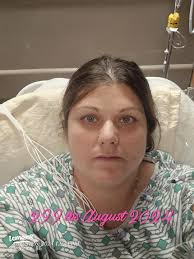 My Life-Changing Gastric Bypass Journey