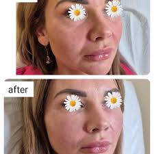 Käyttäjän AlexPmu&aesthetics profiili