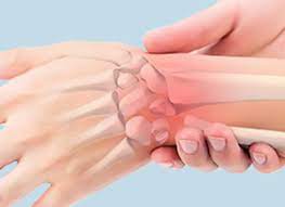 Sprained Wrist | Wrist Sprain | South Florida Hand Center