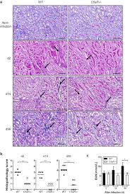 The complement factor 5a receptor 1 has a pathogenic role in chronic  inflammation and renal fibrosis in a murine model of chronic pyelonephritis 
