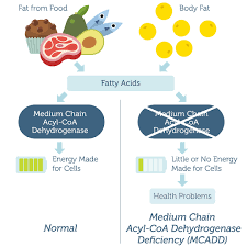 Image result for MCAD Deficiency