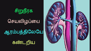 Symptoms Of Kidney Failure Health Tips In Tamil Youtube